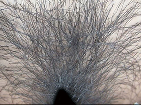 300人のまん毛3　サンプル画像02